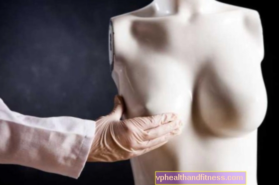 Tipuri de mastectomie: amputare simplă a sânului