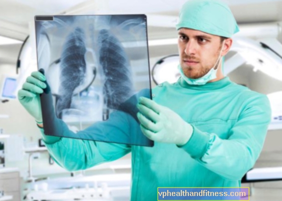 Absceso pulmonar: causas, síntomas, tratamiento