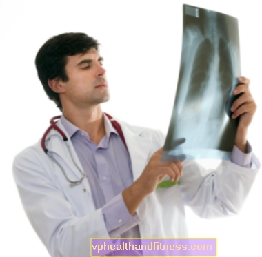 Lungeemfysem: årsaker, symptomer, behandling