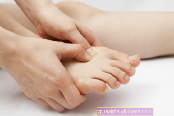 Üreges láb - okai, kezelése és megelőzése