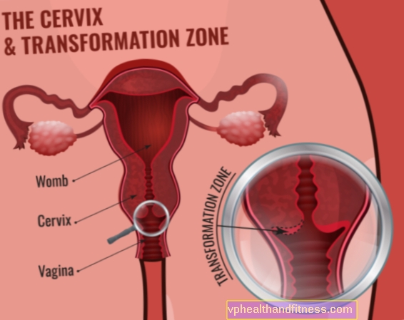 El cuello uterino: estructura, funciones, enfermedades.