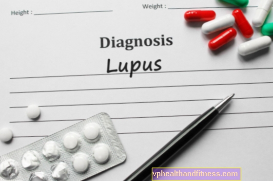 Systémový lupus erythematodes. Léčba systémového lupus erythematodes