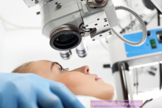 Trabeculoplastica laser nel trattamento del glaucoma