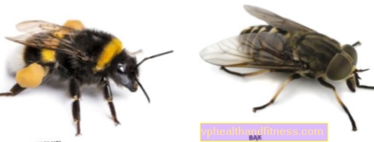 Lebah tidak pahit. Seperti apa rupa lebah dan apakah mereka menyengat?