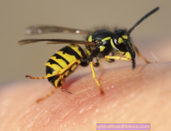 PICADO de una abeja o una avispa: ¿cómo dar primeros auxilios?