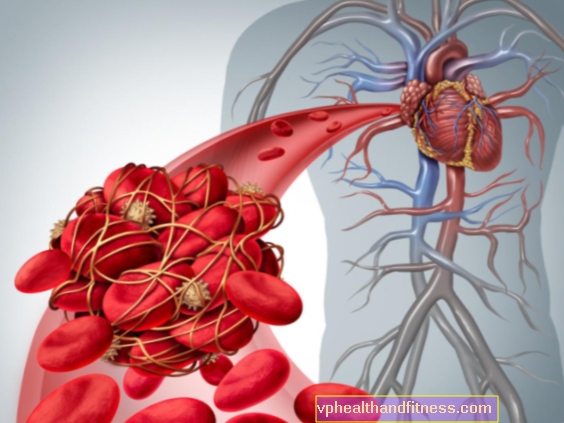 Krvožilni sustav: struktura krvožilnog sustava