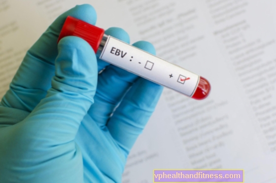O vírus Epstein-Barr (EBV) pode causar câncer. O que é EBV?