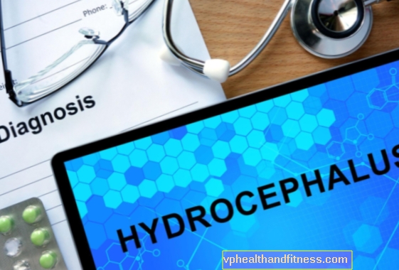 Hidrocefalia normotensiva (síndrome de Hakim): causas, síntomas, tratamiento