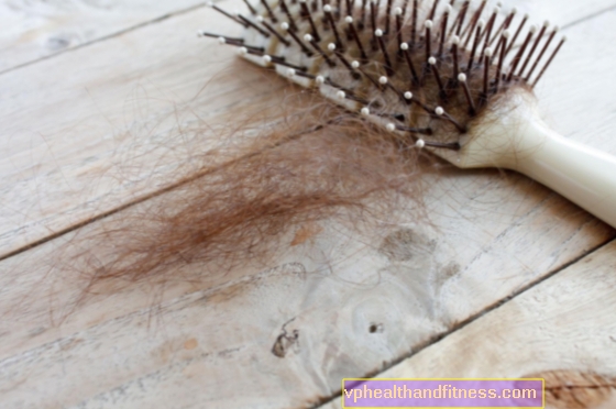 Vypadávání vlasů - příčiny. Jaké nemoci způsobují plešatost?