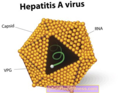 Hepatitis A (ictericia alimentaria): causas, síntomas, tratamiento y prevención