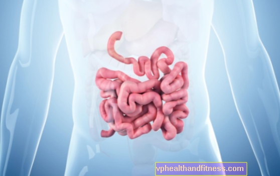 Infiammazione dell'intestino: cause. Cosa causa l'infiammazione intestinale?