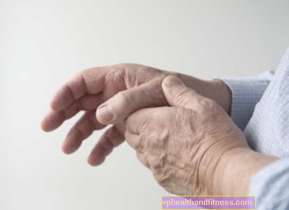 Artritis: causas, tipos, síntomas y tratamiento