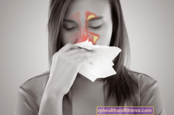 Sinusitis: oorzaken, symptomen en behandeling