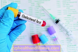 Übernehmen Sie die Kontrolle über Ihr Cholesterin - was tun, um es normal zu halten?