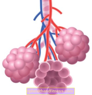 Eisenmengerin oireyhtymä: keuhkojen verisuonisairauksien syyt, oireet ja hoito