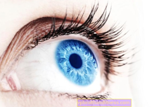 El síndrome de Horner es un daño al nervio del ojo.