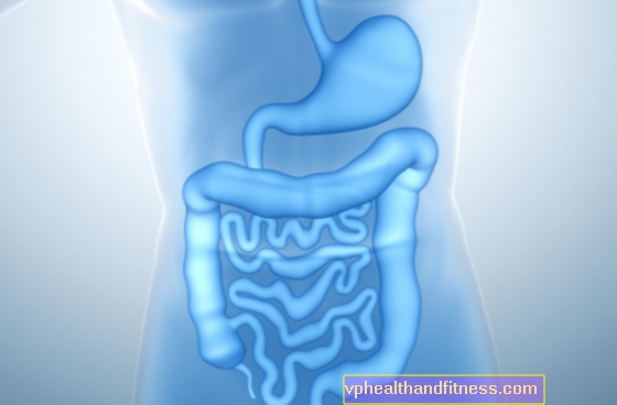 Syndrome de l'intestin court - causes, symptômes, traitement
