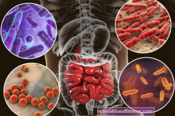 Plonosios žarnos bakterijų peraugimas (SIBO sindromas) - priežastys, simptomai, gydymas