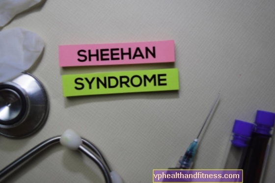 Синдром Шихана - причины, симптомы, лечение