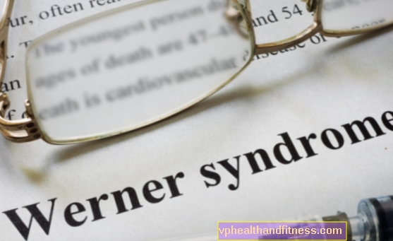 Síndrome de Werner: causas, síntomas, diagnóstico, tratamiento