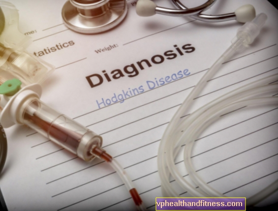 Linfoma maligno o linfoma de Hodgkin: causas, síntomas, tratamiento