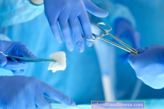 Lekatan pasca operasi: pencegahan dan rawatan